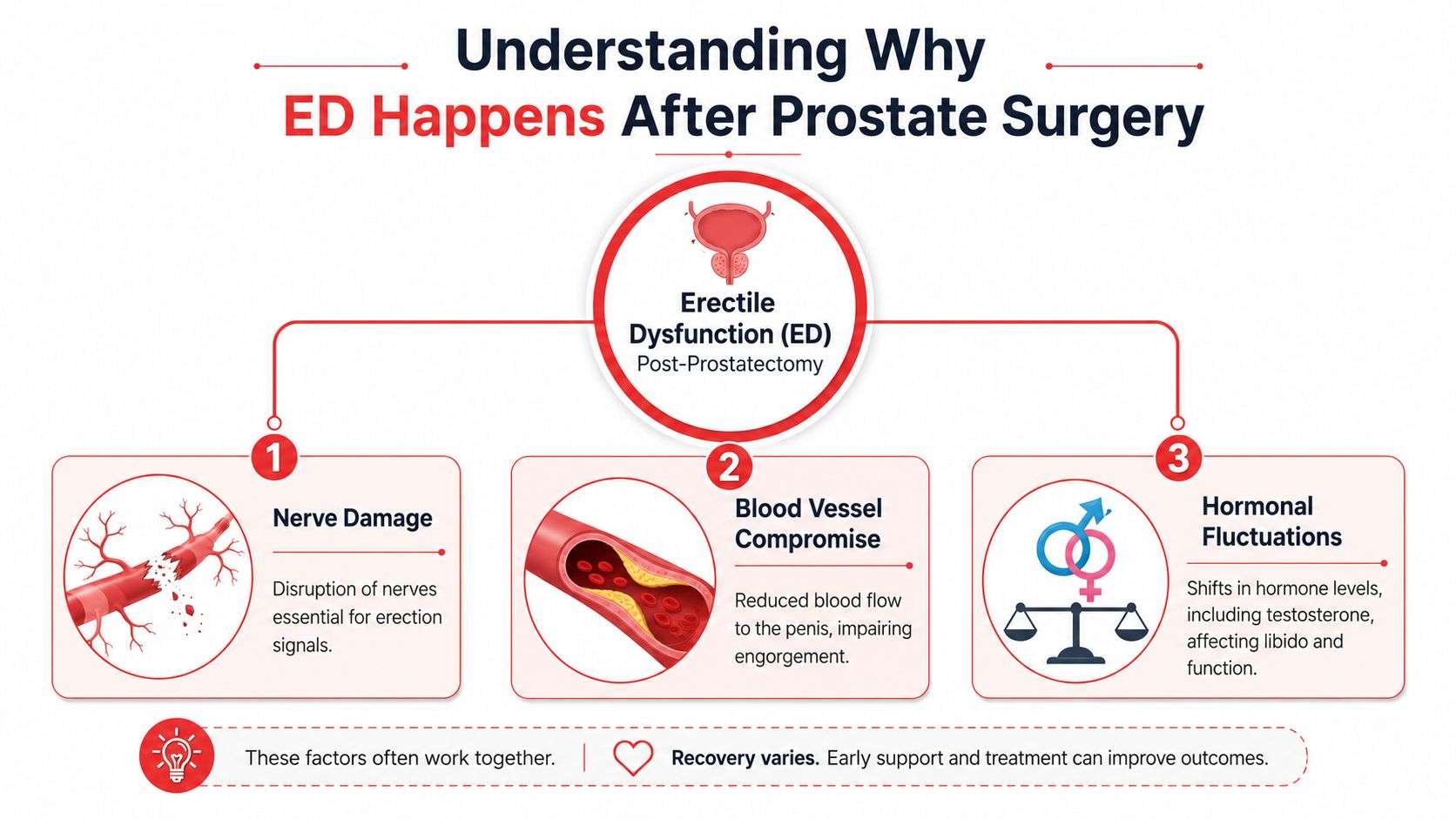 An infographic explaining the causes of erectile dysfunction following prostate surgery including nerve damage, blood vessel compromise, and hormones.