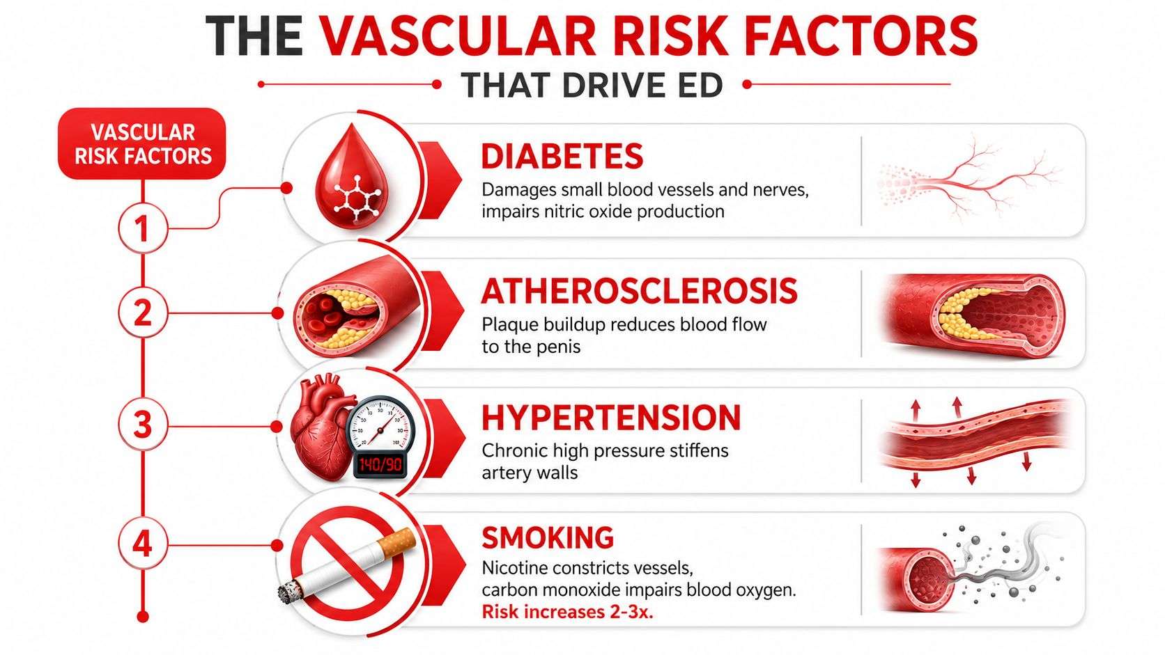 An infographic detailing four main vascular risk factors that contribute to erectile dysfunction, including diabetes, atherosclerosis, hypertension, and smoking.